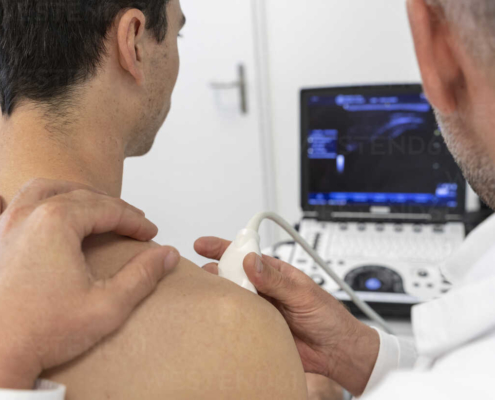 frozen shoulder echografie